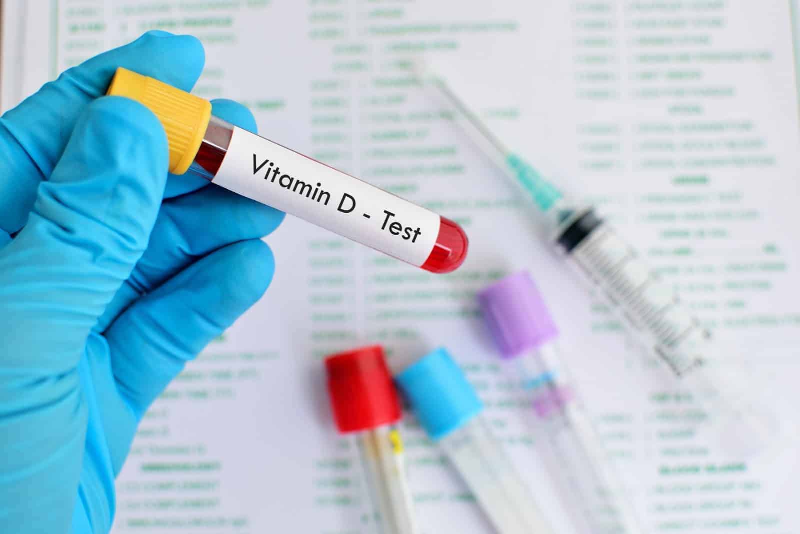 Vitamin D blood test